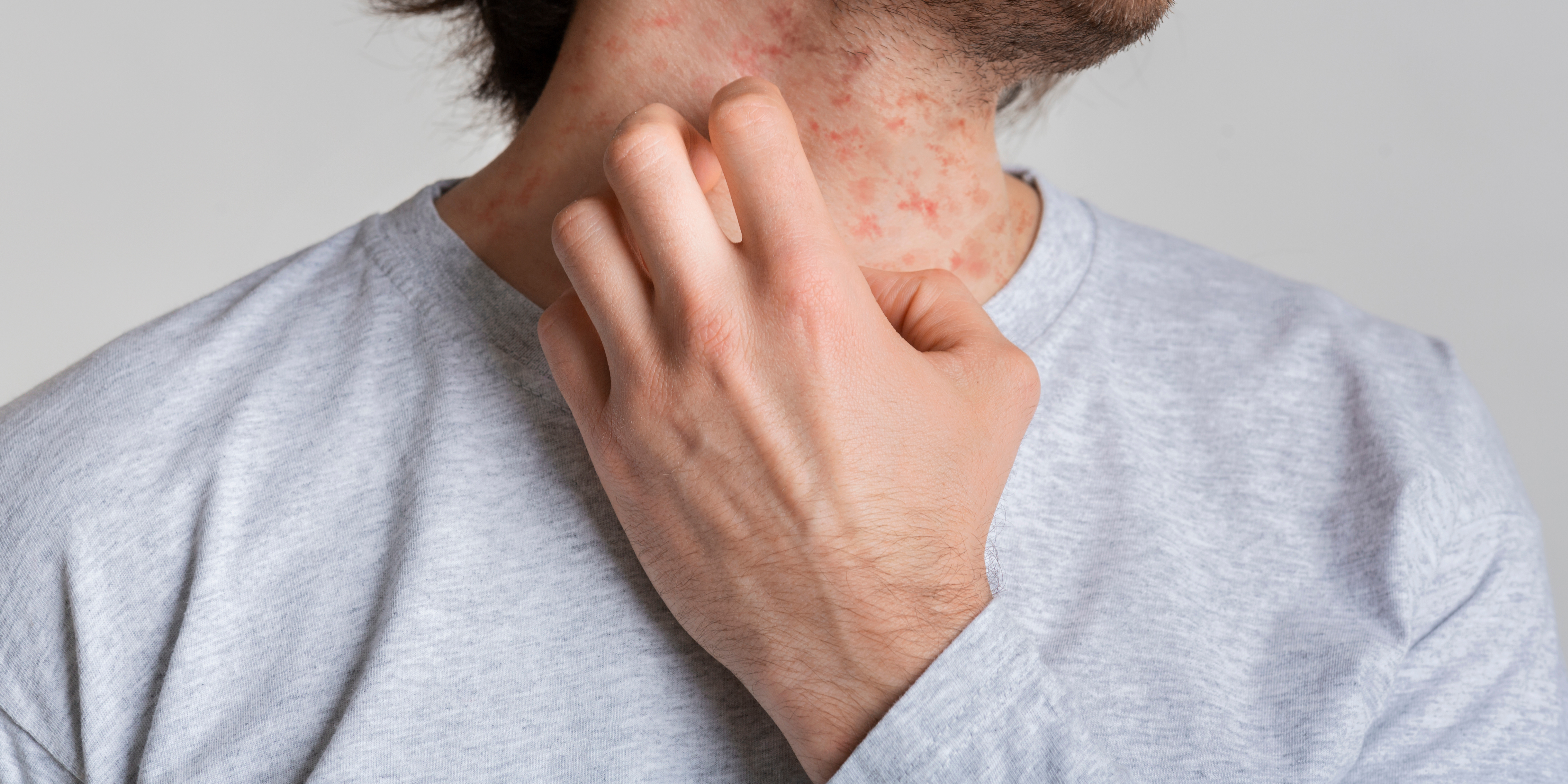 A man wearing a t-shirt scratching at his neck