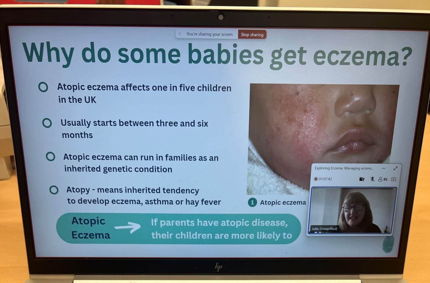 A picture of a zoom meeting - the slide on the screen says: Why do some babies get eczema